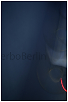 Ankerwurf